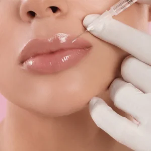 Lip Filler